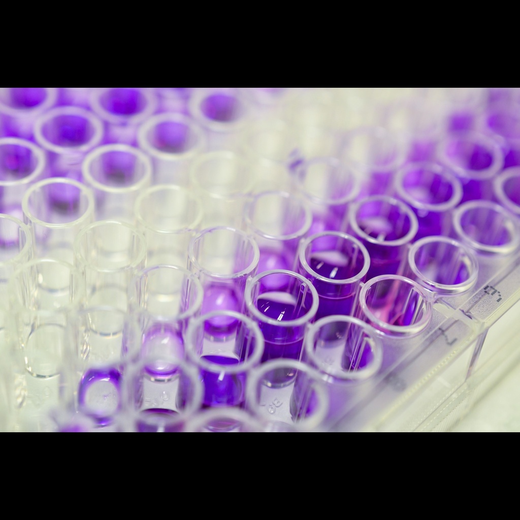 Human Collagen Type XI Alpha 1 ''COL11a1'' ELISA Assay   96 welsl plate